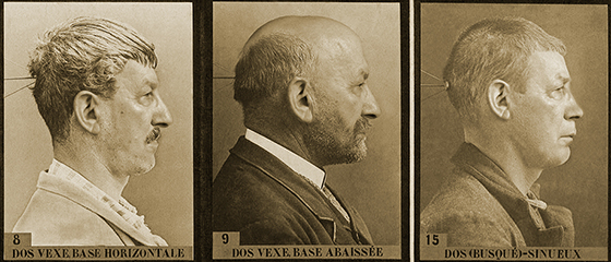 08AfterBertillon_TableauSynoptiqueduNez_DetailSplash
